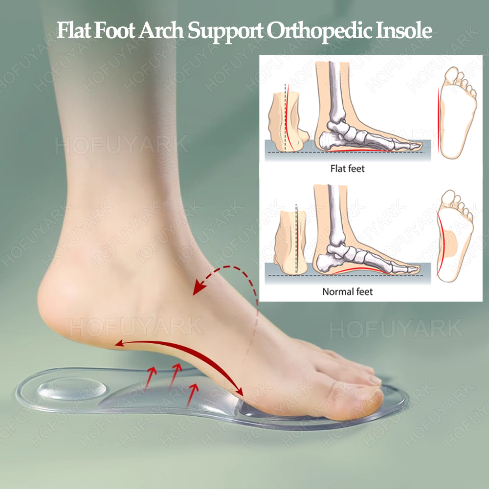 Silicone Gel Insoles Orthopedi - Women'S Shoes High Arch Support recension och pris