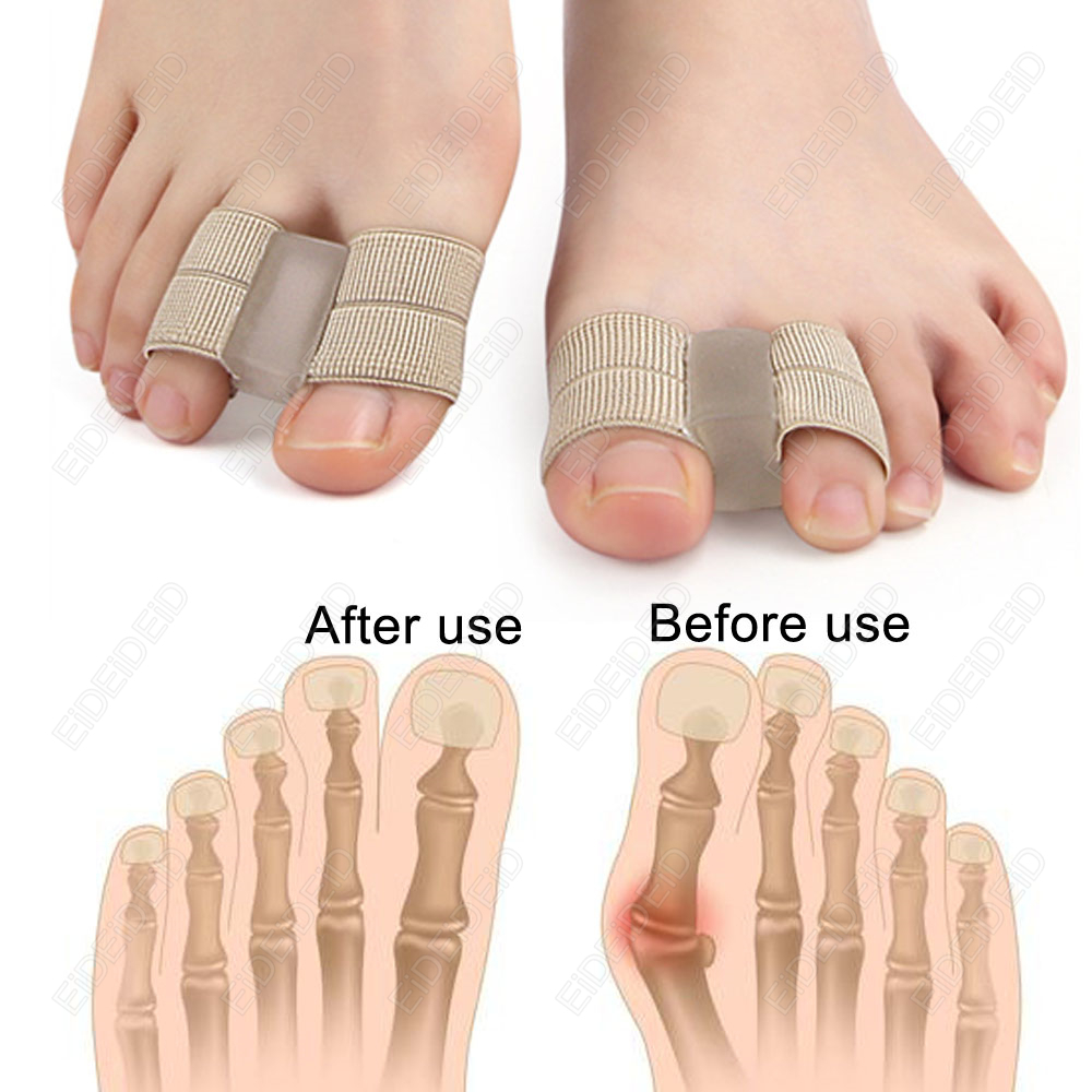 Bunion toe Corrector Orthotics - Women'S Shoes For Bunions recension och pris
